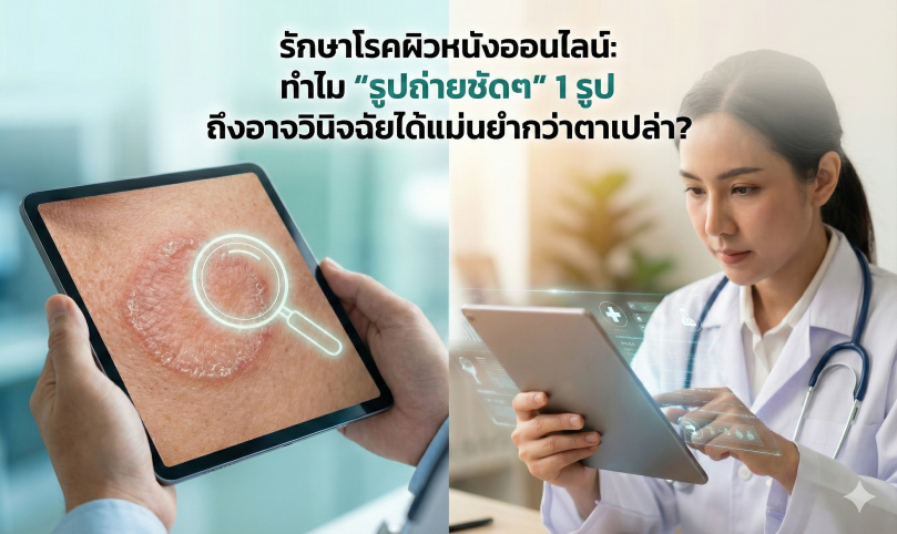 รักษาโรคผิวหนังออนไลน์: ทำไม ‘รูปถ่ายชัดๆ’ 1 รูป ถึงอาจวินิจฉัยได้แม่นยำกว่าตาเปล่า?